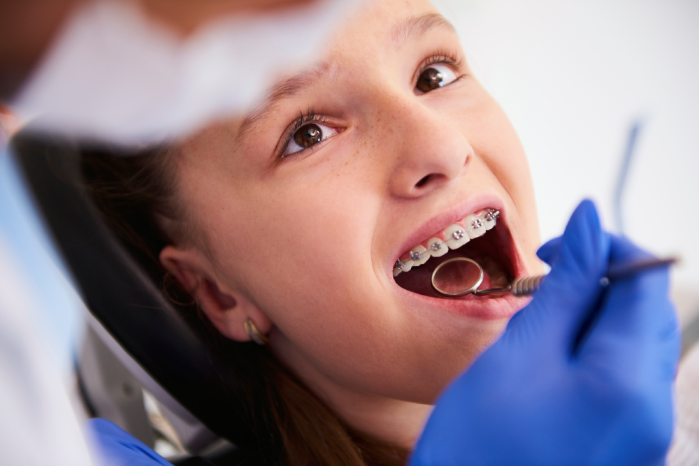 Implante Dentário: existe idade mínima para o procedimento?