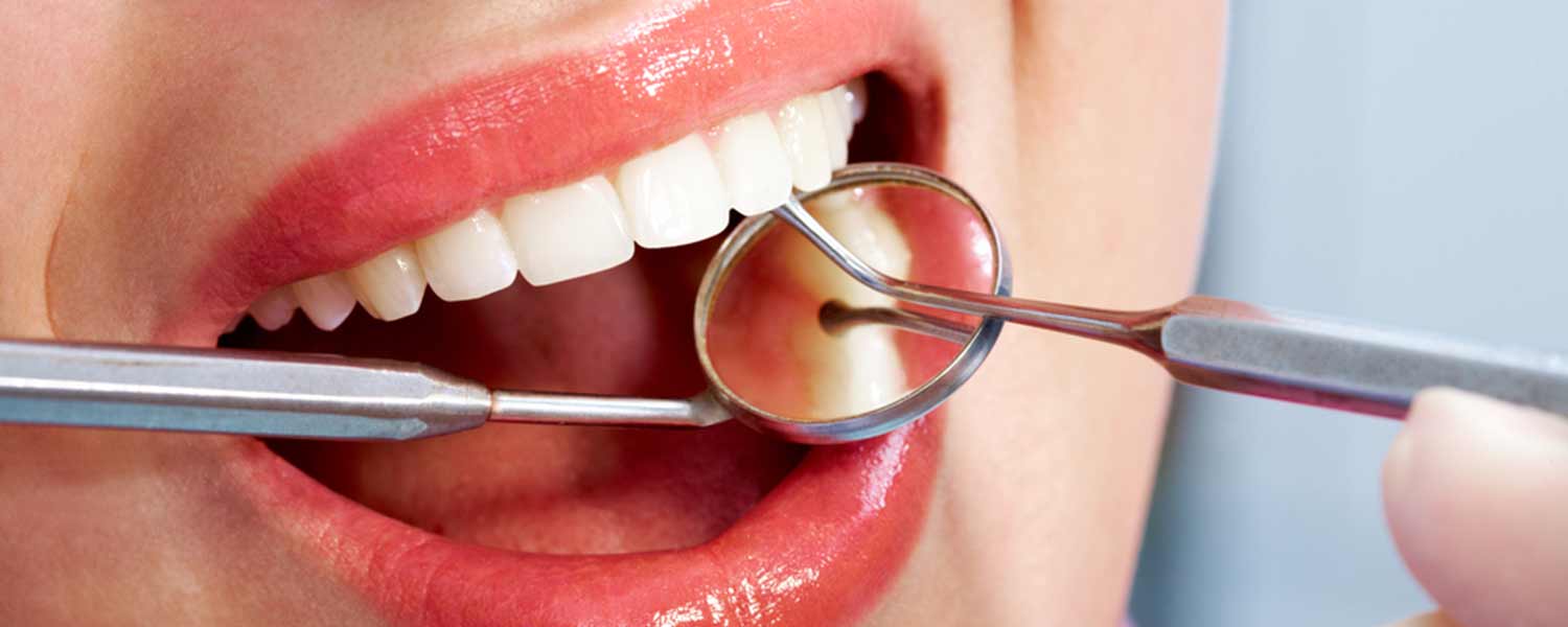 Limpeza dos Dentes: Um Guia para um Belo Sorriso!