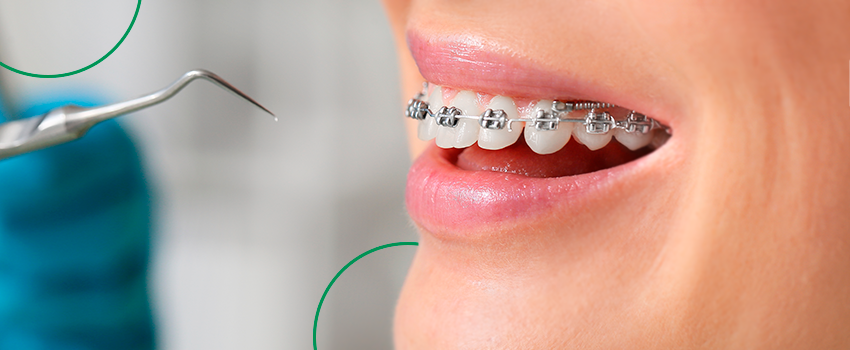 Inovações em Ortodontia: A Evolução dos Aparelhos e Tratamentos